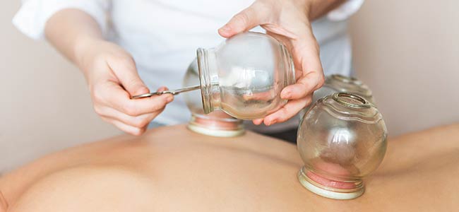 Acupuncture, Cupping and More